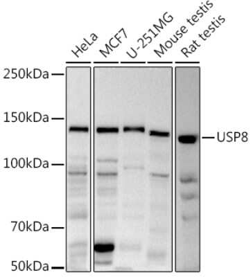 Western Blot: UBPY/USP8 Antibody [NBP2-94523] - Western blot analysis of extracts of various cell lines, using (NBP2-94523) at 1:1000 dilution. Secondary antibody: HRP Goat Anti-Rabbit IgG (H+L) at 1:10000 dilution. Lysates/proteins: 25ug per lane. Blocking buffer: 3% nonfat dry milk in TBST. Detection: ECL Basic Kit. Exposure time: 30s.